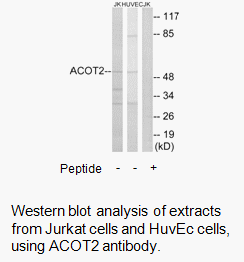 Product image for ACOT2 Antibody