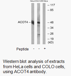 Product image for ACOT4 Antibody