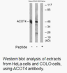Product image for ACOT4 Antibody