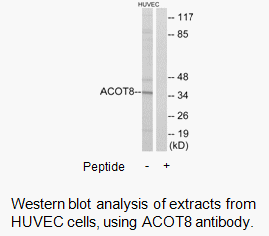Product image for ACOT8 Antibody