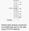 Product image for LPCAT2 Antibody