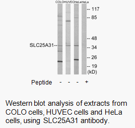 Product image for SLC25A31 Antibody