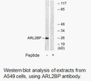 Product image for ARL2BP Antibody