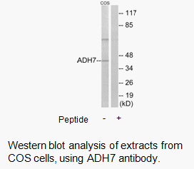 Product image for ADH7 Antibody