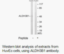 Product image for ALDH3B1 Antibody