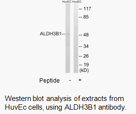 Product image for ALDH3B1 Antibody
