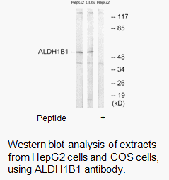 Product image for ALDH1B1 Antibody