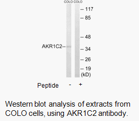 Product image for AKR1C2 Antibody
