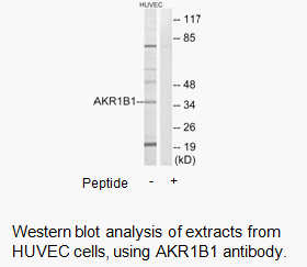 Product image for AKR1B1 Antibody