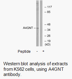 Product image for A4GNT Antibody