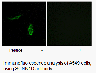 Product image for SCNN1D Antibody