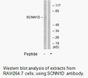 Product image for SCNN1D Antibody