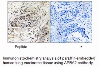 Product image for APBA2 Antibody