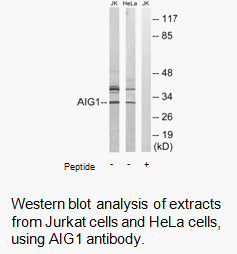 Product image for AIG1 Antibody
