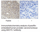Product image for AMOTL1 Antibody