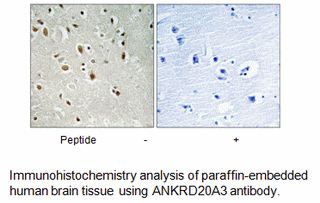 Product image for ANKRD20A3 Antibody