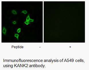 Product image for KANK2 Antibody