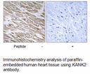 Product image for KANK2 Antibody