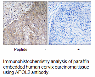 Product image for APOL2 Antibody