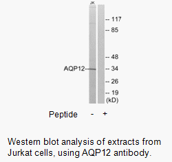 Product image for AQP12 Antibody