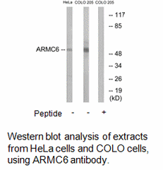 Product image for ARMC6 Antibody