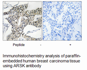 Product image for ARSK Antibody