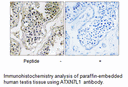 Product image for ATXN7L1 Antibody