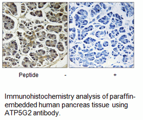 Product image for ATP5G2 Antibody