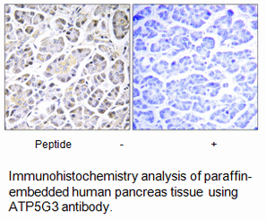 Product image for ATP5G3 Antibody