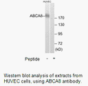 Product image for ABCA8 Antibody