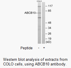 Product image for ABCB10 Antibody