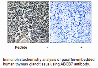 Product image for ABCB7 Antibody