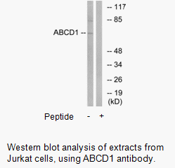Product image for ABCD1 Antibody