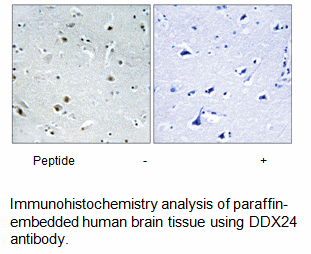 Product image for DDX24 Antibody