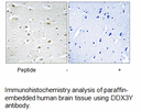 Product image for DDX3Y Antibody