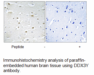 Product image for DDX3Y Antibody