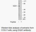 Product image for DQX1 Antibody