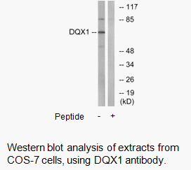 Product image for DQX1 Antibody