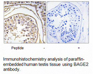 Product image for BAGE2 Antibody