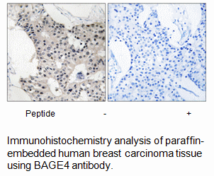 Product image for BAGE4 Antibody