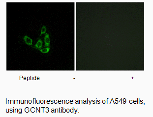 Product image for GCNT3 Antibody