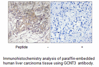 Product image for GCNT3 Antibody