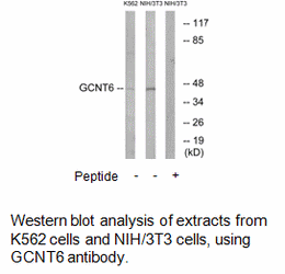 Product image for GCNT6 Antibody