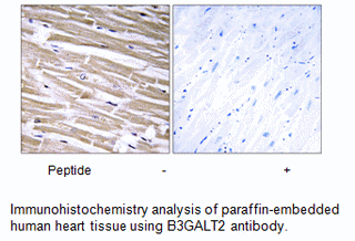 Product image for B3GALT2 Antibody