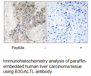 Product image for B3GALTL Antibody