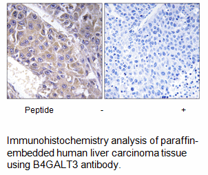 Product image for B4GALT3 Antibody