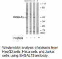 Product image for B4GALT3 Antibody