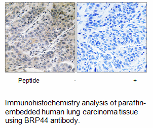 Product image for BRP44 Antibody
