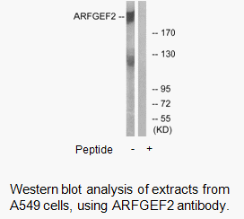Product image for ARFGEF2 Antibody