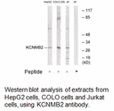 Product image for KCNMB2 Antibody